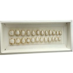 Kunstige Negle Glitter Design